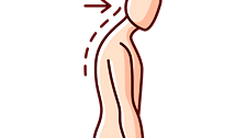 Kyphosis Treatment